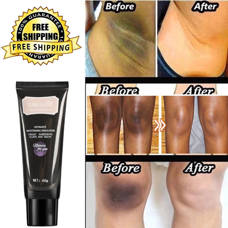 IUALLURE Intimate Whitening Cream ( BUY 1 GET 1 FREE )