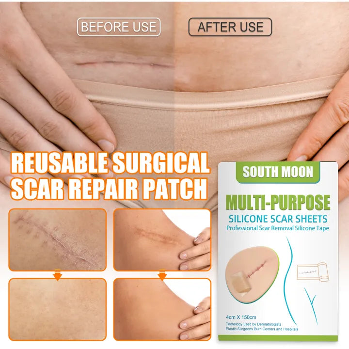 South Moon Multi-Purpose Silicone Scar Sheet ( BUY 1 GET 1 FREE )