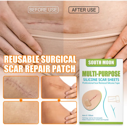 South Moon Multi-Purpose Silicone Scar Sheet ( BUY 1 GET 1 FREE )