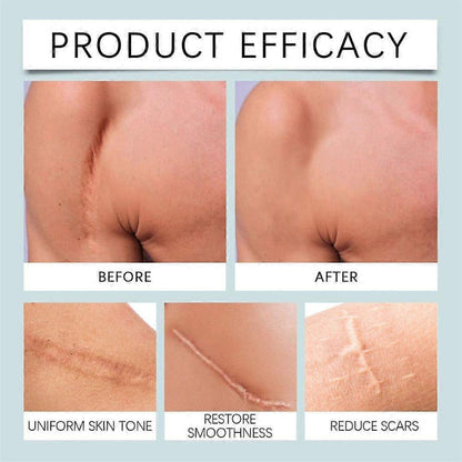 ✨ LANISKA Silicone Scar Tape ✨ ( BUY 1 GET 1 FREE )