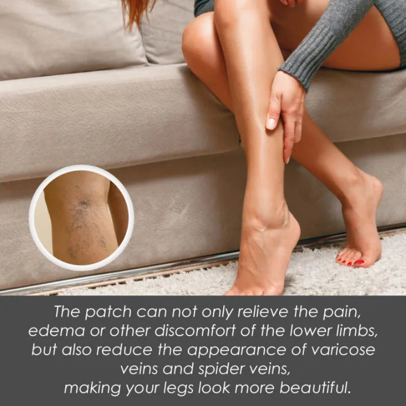 ✨ South Moon Varicose Veins Relief Patches ✨ ( BUY 1 GET 1 FREE )