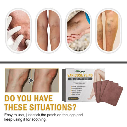 ✨ South Moon Varicose Veins Relief Patches ✨ ( BUY 1 GET 1 FREE )