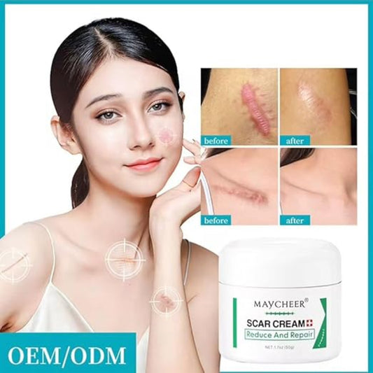 ✨ MAYCHEER Scar Cream  Reduce & Repair ✨ ( BUY 1 GET 1 FREE )