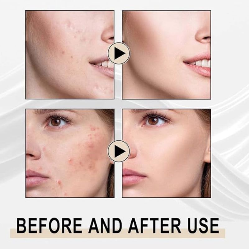 🍃✨ Papaya’s Essence Body Scrub ✨🍃 ( BUY 1 GET 1 FREE )