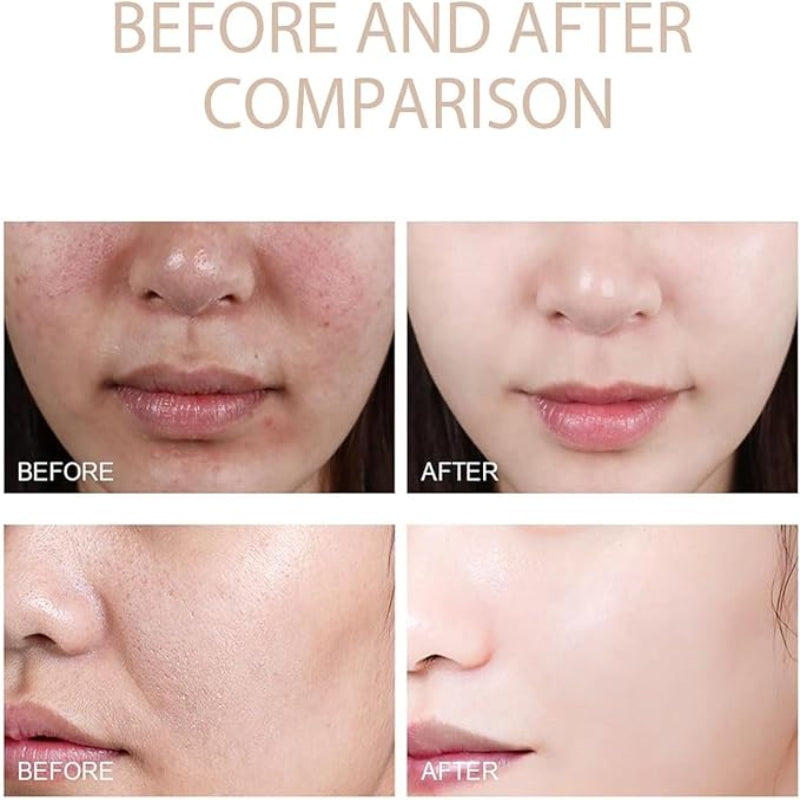 KOEC Facial Exfoliating Gel ( BUY 1 GET 1 FREE)