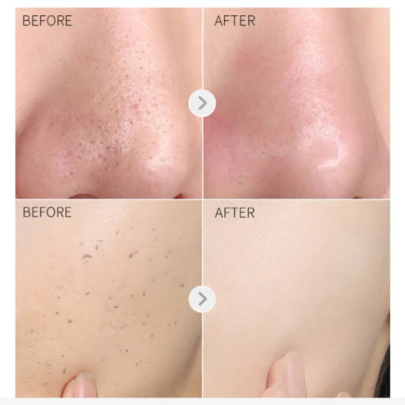 ✨ Lafunni Vitamin C Exfoliating Moisturizing Gel ✨ ( BUY 1 GET 1 FREE )