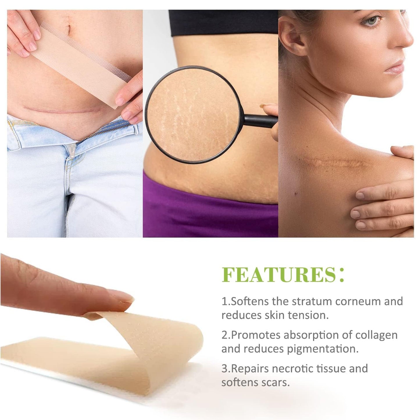 South Moon Multi-Purpose Silicone Scar Sheet ( BUY 1 GET 1 FREE )