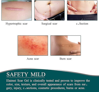 Laniska Silicone Scar Sheets ( BUY 1 GET 1 FREE )