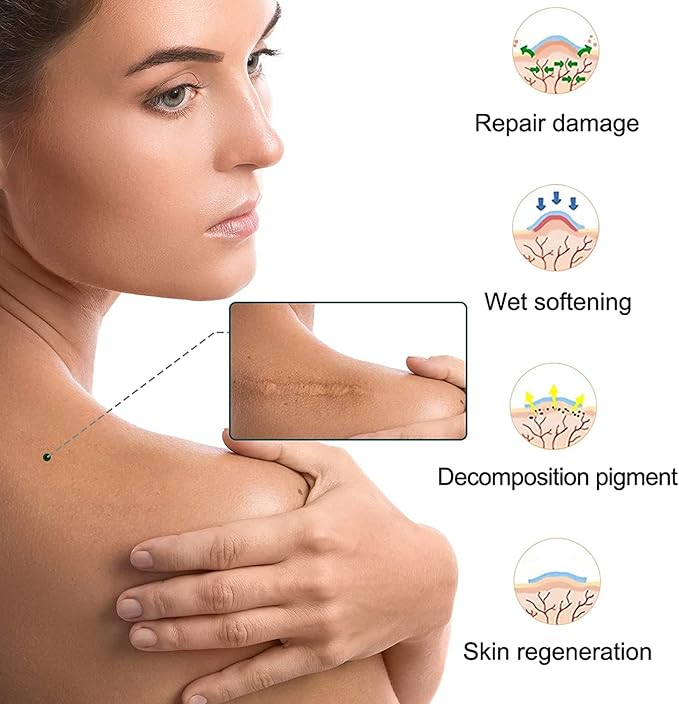 Laniska Silicone Scar Sheets ( BUY 1 GET 1 FREE )