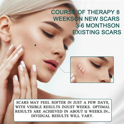 Laniska Silicone Scar Sheets ( BUY 1 GET 1 FREE )