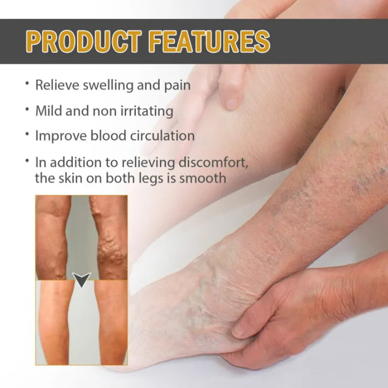 ✨ South Moon Varicose Veins Relief Patches ✨ ( BUY 1 GET 1 FREE )