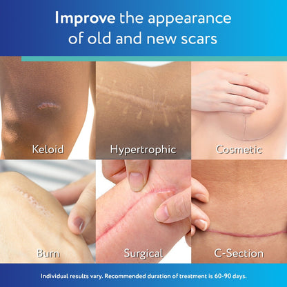 ✨ ScarAway Medical-Grade Silicone Clear Scar Sheet ✨ ( BUY 1 GET 1 FREE )