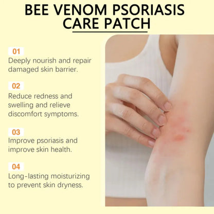 ✨ South Moon Bee Venom Psoriasis Care Patch ✨ ( BUY 1 GET 1 FREE )