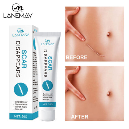 LANEMAY SCAR DISAPPEARS CREAM ( BUY 1 GET 1 FREE )