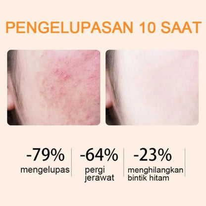 Orange Exfoliating Whitening Gel ( BUY 1 GET 1 FREE )