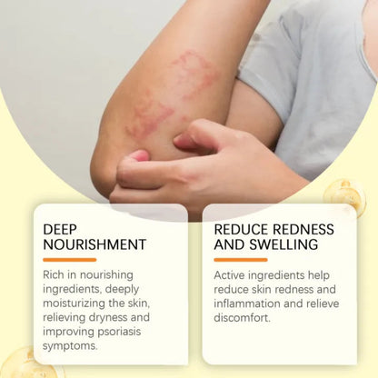 ✨ South Moon Bee Venom Psoriasis Care Patch ✨ ( BUY 1 GET 1 FREE )