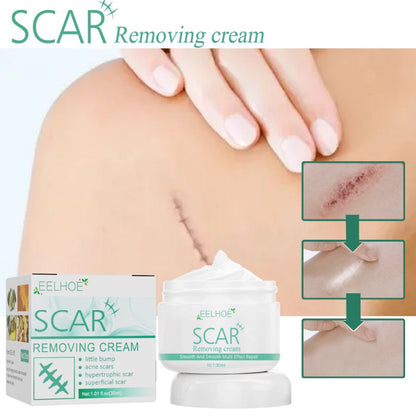 ✨ EELHOE Scar Remove Cream ✨ ( BUY 1 GET 1 FREE )