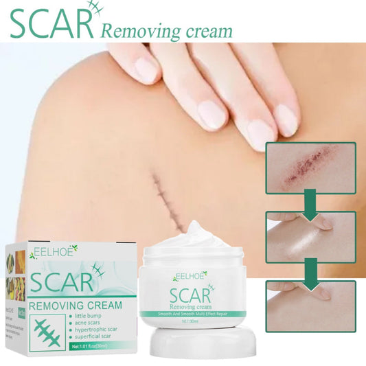 ✨ EELHOE Scar Remove Cream ✨ ( BUY 1 GET 1 FREE )