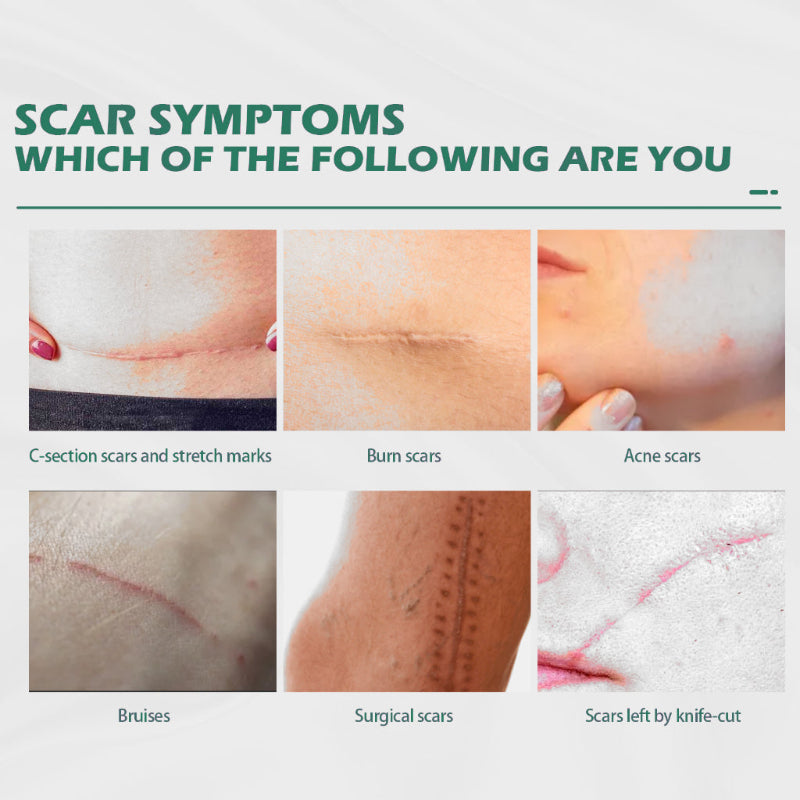 ✨ EELHOE Scar Remove Cream ✨ ( BUY 1 GET 1 FREE )