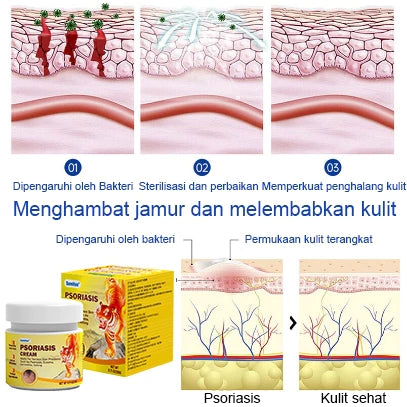 Sumifun Anti - psoriasis Cream (BUY 1 GET 1 FREE)