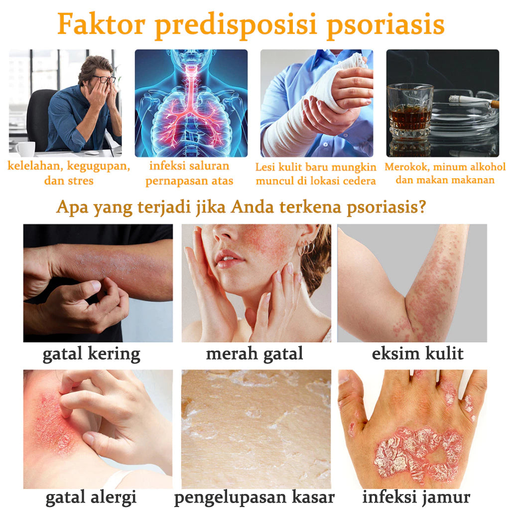 Sumifun Anti - psoriasis Cream (BUY 1 GET 1 FREE)