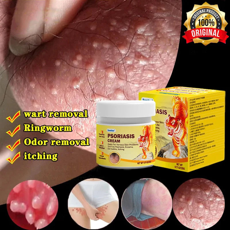 Sumifun Anti - psoriasis Cream (BUY 1 GET 1 FREE)
