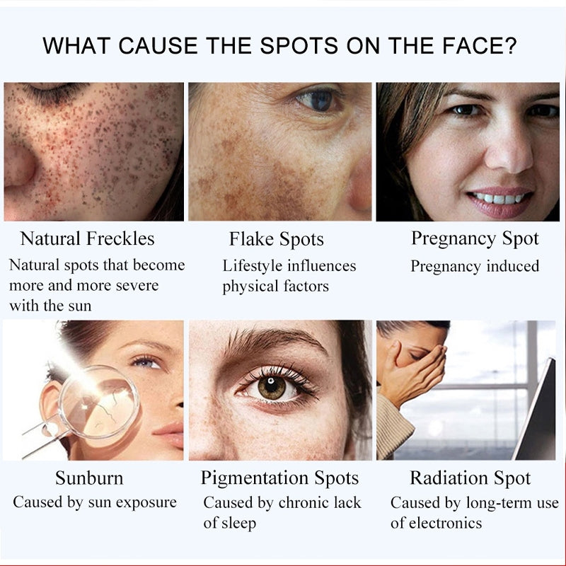 377 Whitening Dark Spots Cream ( BUY 1 GET 1 FREE )