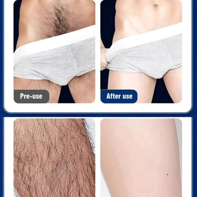 Men's private hair removal cream ( BUY 1 GET 1 FREE )