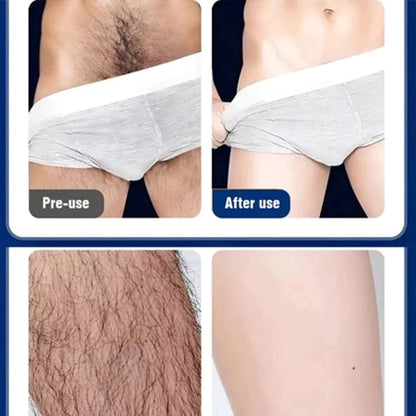 Men's private hair removal cream ( BUY 1 GET 1 FREE )