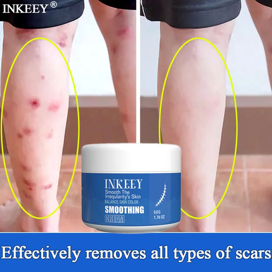 ✨🌿 Inkeey Scar Removal Cream 🌿✨ (BUY 1 GET 1 FREE )