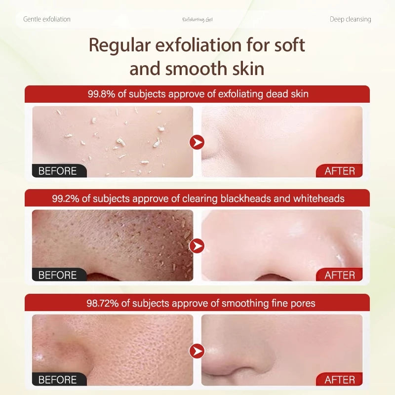 Exfoliating Face Scrub & Peeling Gel ( BUY 1 GET 1 FREE )