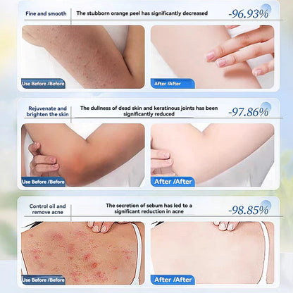 Niacinamide Whitening Exfoliating Body Scrub Gel ( BUY 1 GET 1 FREE )
