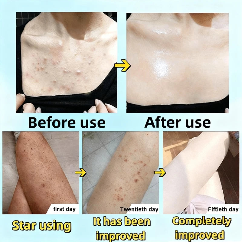 Niacinamide Whitening Exfoliating Body Scrub Gel ( BUY 1 GET 1 FREE )