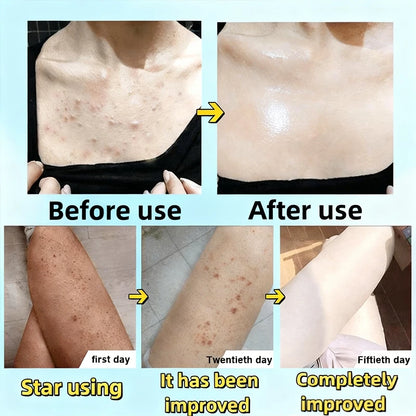 Niacinamide Whitening Exfoliating Body Scrub Gel ( BUY 1 GET 1 FREE )