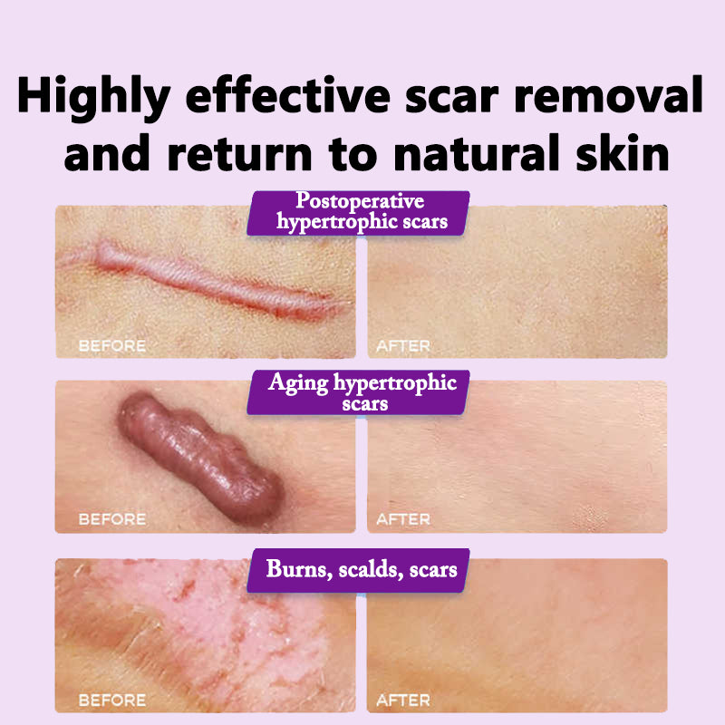 🌿✨ DR JUNGLE MULTI-PURPOSE SCAR REMOVAL PATCH ✨🌿 ( BUY 1 GET 1 FREE )