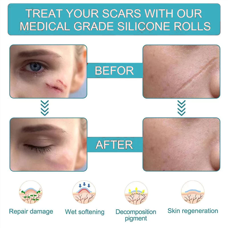 Medical Silicone🔥 scar patch ( BUY 1 GET 1 FREE )