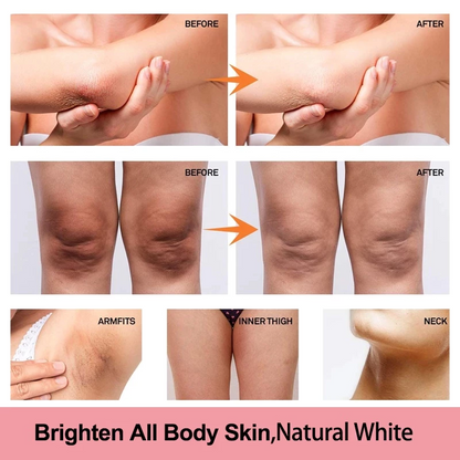 Radiance Skin Whitening Cream ( BUY 1 GET 1 FREE )