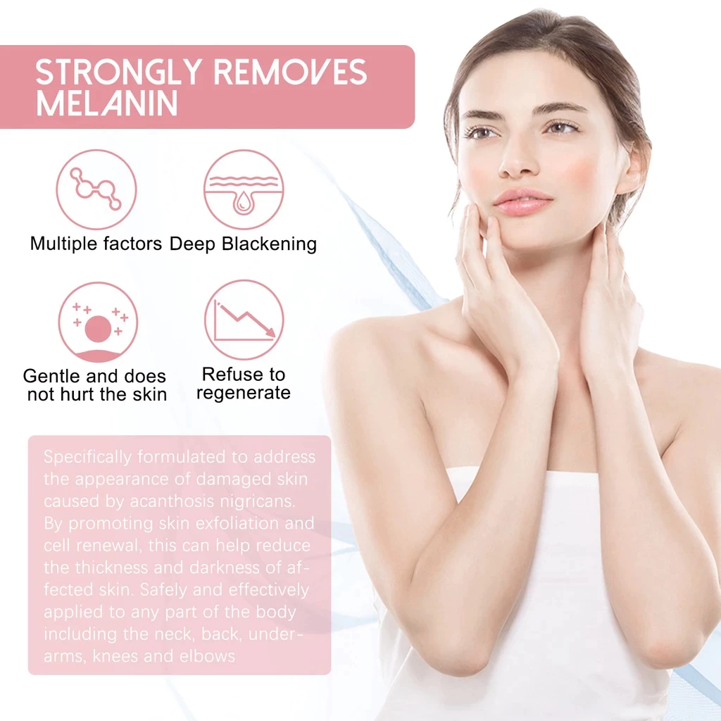 Radiance Skin Whitening Cream ( BUY 1 GET 1 FREE )