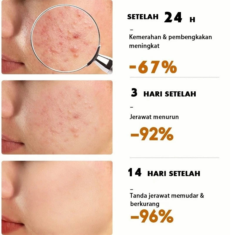 ✨ Men’S HK Moisturiser Whitening Cream ✨( BUY 1 GET 1 FREE )
