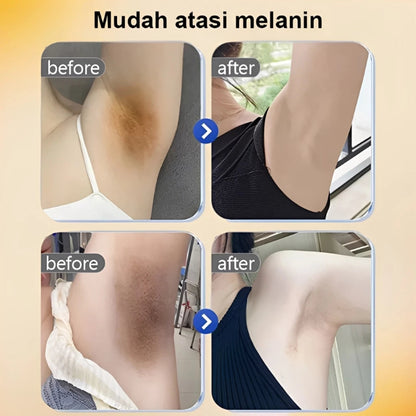 Lydimoon underarm whitening cream ( BUY 1 GET 1 FREE )