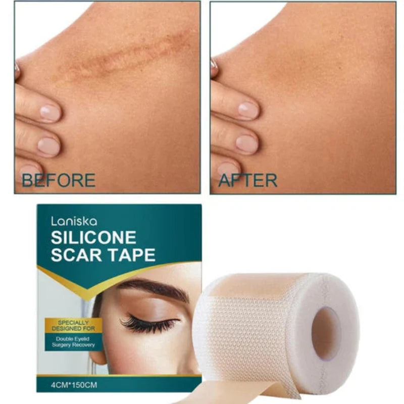 ✨ LANISKA Silicone Scar Tape ✨ ( BUY 1 GET 1 FREE )