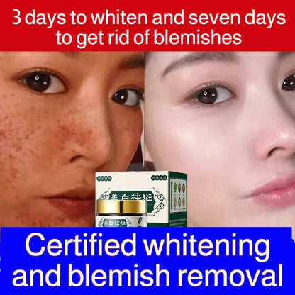 Herbal Whitening Freckle Cream ( Buy 1 Get 1 Free )