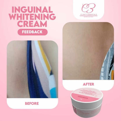 Radiance Skin Whitening Cream ( BUY 1 GET 1 FREE )