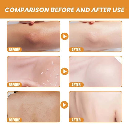 Lemon Sparkling Peeling Gel ( BUY 1 GET 1 FREE )