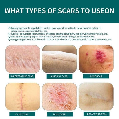 ✨🩹 Qustere Silicone Scar Sheet 🩹✨ ( BUY 1 GET 1 FREE )