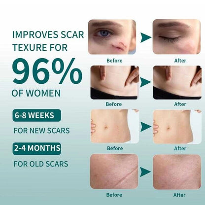 ✨🩹 Qustere Silicone Scar Sheet 🩹✨ ( BUY 1 GET 1 FREE )