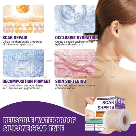✨ Scar Removal EFFECTIVE SHEET ✨ ( BUY 1 GET 1 FREE )