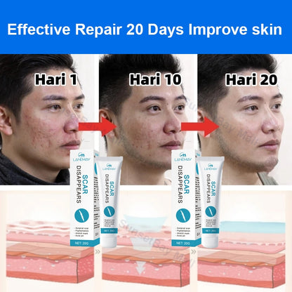 LANEMAY SCAR DISAPPEARS CREAM ( BUY 1 GET 1 FREE )