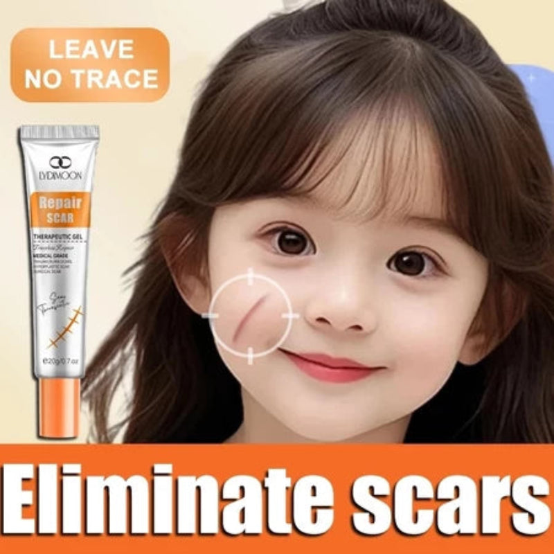 Lydmoon Scar Removal Cream ( BUY 1 GET 1 FREE )
