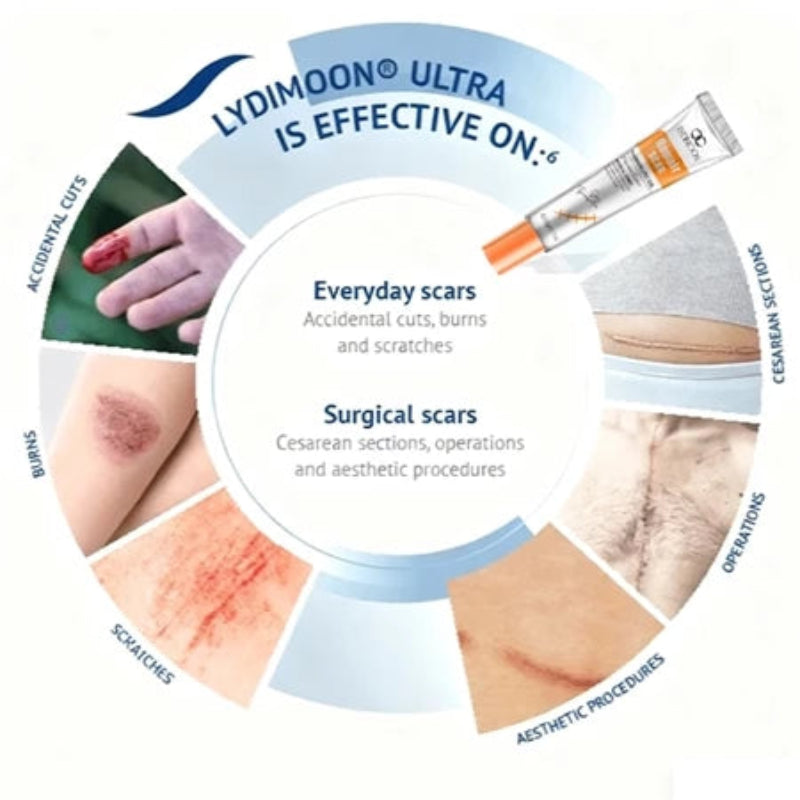 Lydmoon Scar Removal Cream ( BUY 1 GET 1 FREE )